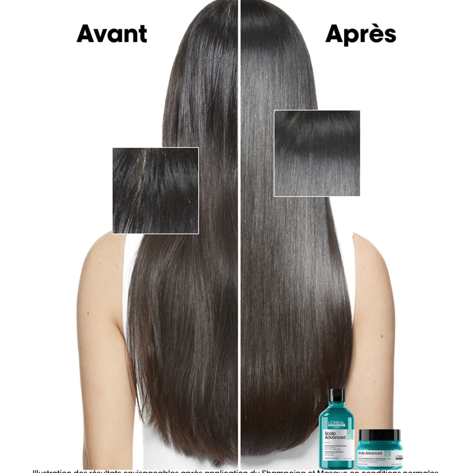 Argile 2-en-1 purifiante anti-gras Scalp Advanced 250ml