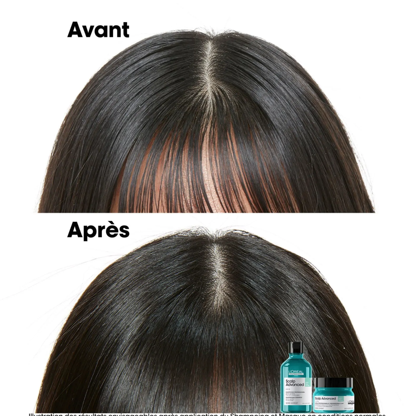 Argile 2-en-1 purifiante anti-gras Scalp Advanced 250ml