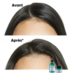 Shampooing dermo-purifiant anti-gras Scalp Advanced 300ml