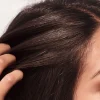 Shampooing purifiant cuir chevelu gras Invigo Scalp Balance