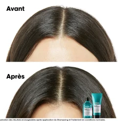Traitement apaisant intense Scalp Advanced